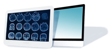 Zwei medizinische Computermonitore, von denen einer CT-Scans anzeigt