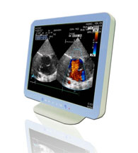 Medical panel pc showing sonogram on screen