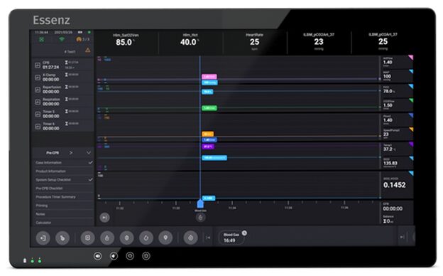 Patient vitals app on the Essenz patient monitor