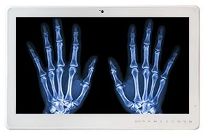 Teguar TM-5510-22 configured for DICOM imaging showing an x-ray of two hands